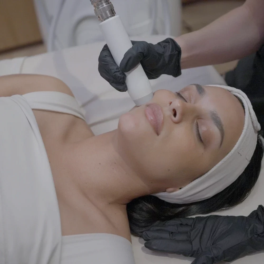 T-Shape 2 facial treatment on the cheek